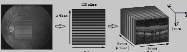 SD-OCT成像示意图
